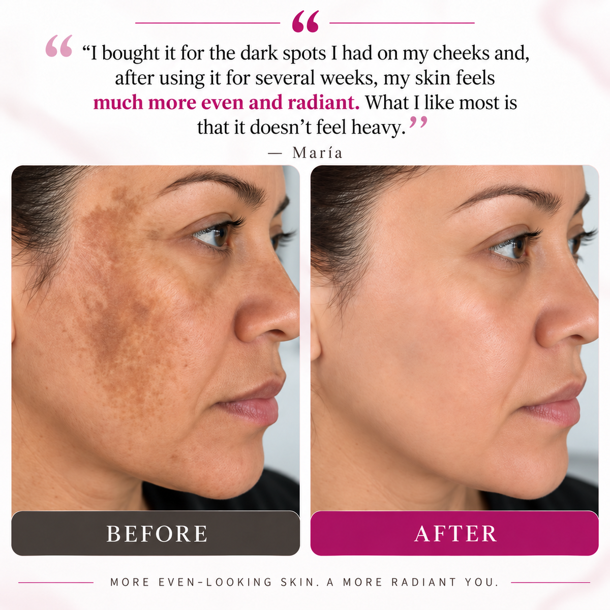 ARBUVIA™ Dark Spot Correcting Cream