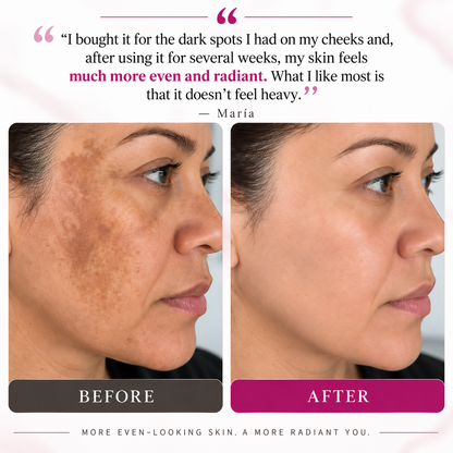 ARBUVIA™ Dark Spot Correcting Cream